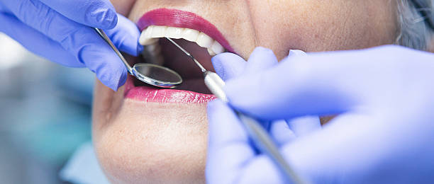Best Urgent Care for Lost Fillings or Crowns in Cetronia, PA